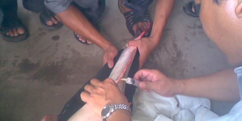 Hoạt động đơn vị